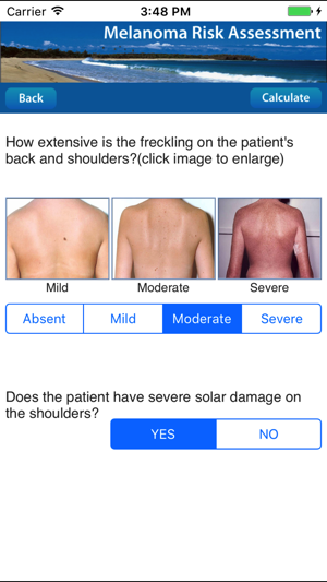 Melanoma Risk Assessment Tool(圖4)-速報App
