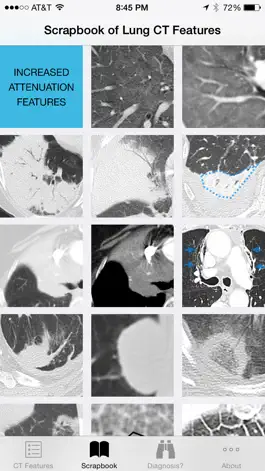 Game screenshot Lung CT Field Guide hack
