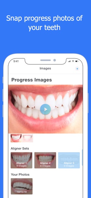 Smart Smile(圖4)-速報App