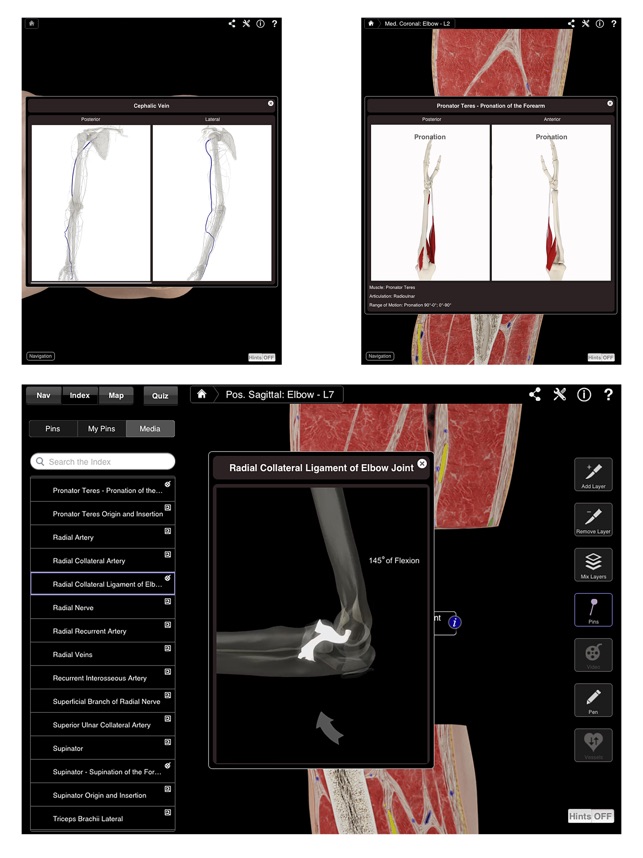 Elbow Pro III for iPad(圖5)-速報App