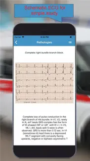 ecg interpretation. lite. problems & solutions and troubleshooting guide - 1