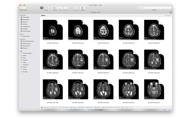 Screenshot #2 pour DICOM Quicklook by OsiriX