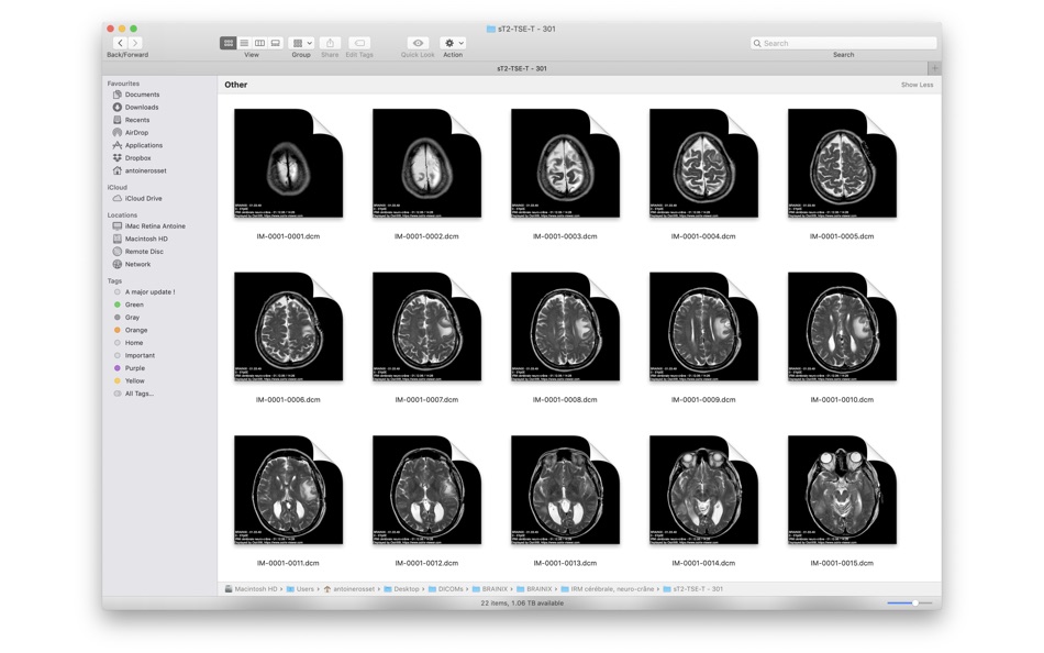 #2. DICOM Quicklook by OsiriX (macOS) 由: Pixmeo SARL