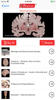 How to cancel & delete neuroanatomy - digital anatomy 2