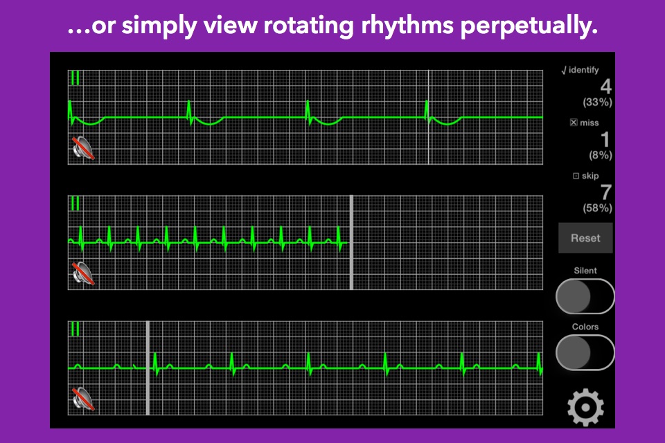 arrhythmia screenshot 3