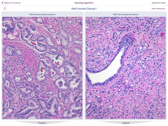 Hopkins Prostate Pathologyのおすすめ画像4