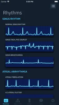 ACLS Rhythms and Quiz iphone bilder 1