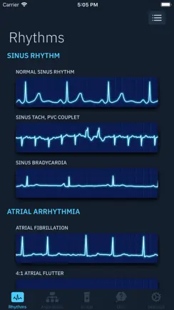ACLS Rhythms and Quiz iPhone image 2