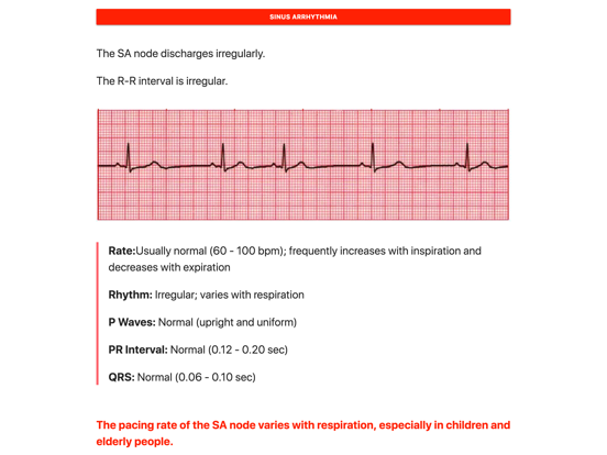 Screenshot #5 pour ECG FlashCards