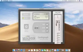 kardiyograf (cardiograph) iphone resimleri 1