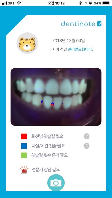 덴티노트(Dentinote) screenshot 3