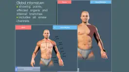 Game screenshot Easy Acupuncture 3D - LITE apk