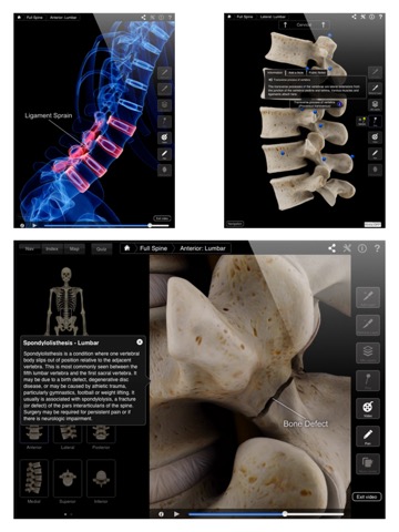 Spine Pro IIIのおすすめ画像4