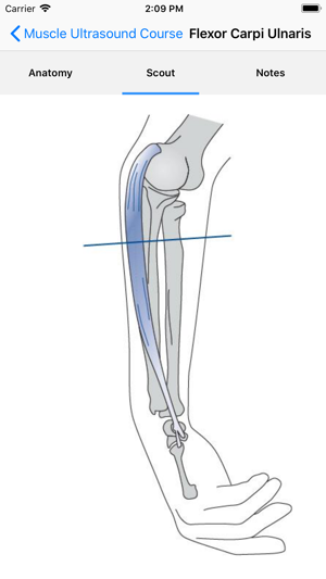 Muscle Ultrasound Course(圖3)-速報App