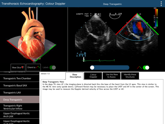 Screenshot #4 pour TEE Colour Doppler