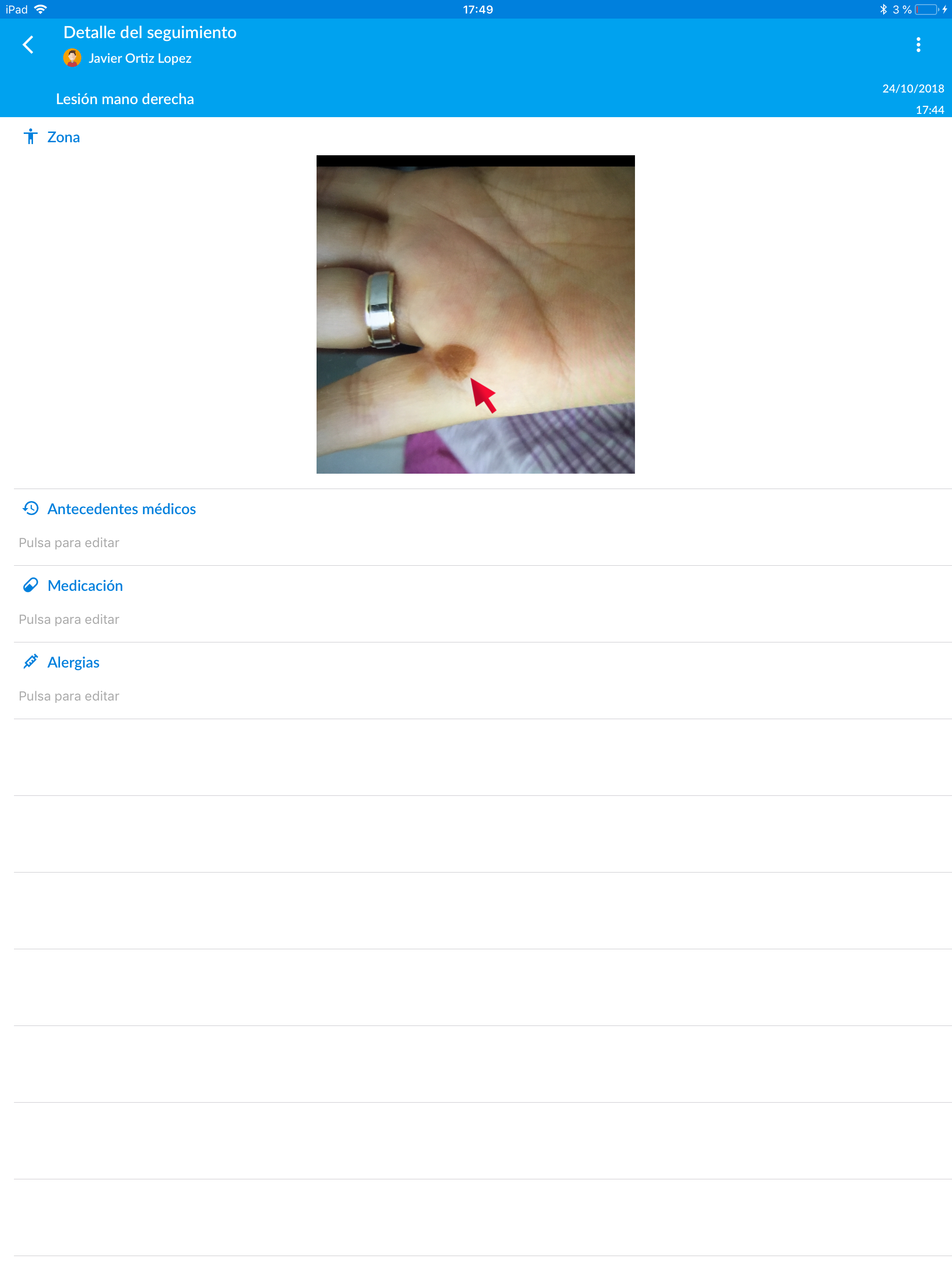 eDerma