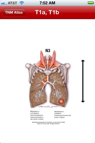 IASLC Staging Handbook screenshot 3