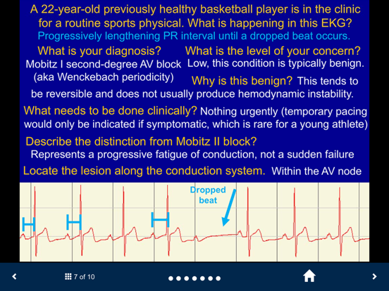 EKG - SecondLook iPad screenshot 5 - Medical app