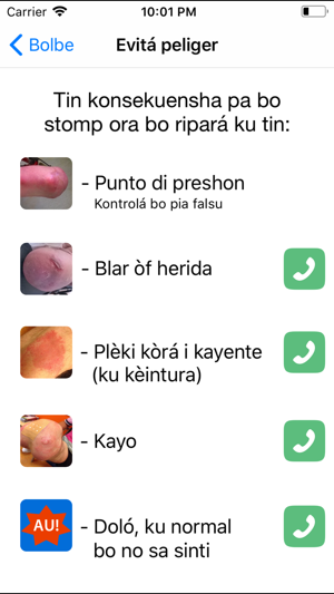 Amputashon di pia i protésis(圖2)-速報App