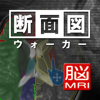 断面図ウォーカー脳MRI-Ryo Matsuda