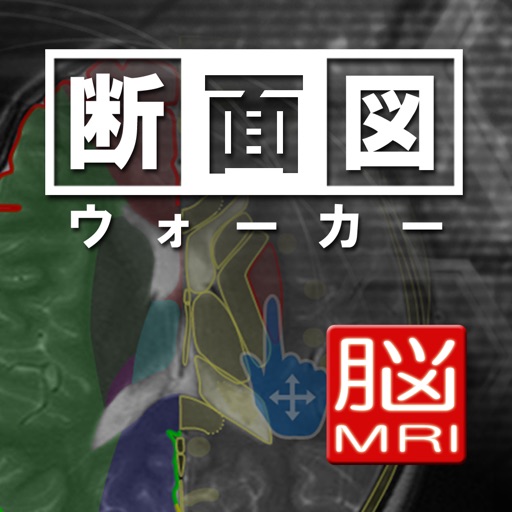 断面図ウォーカー脳MRI