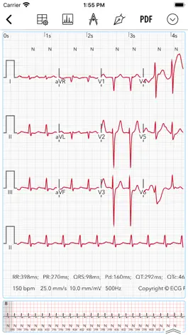 Game screenshot ECG for Doctors hack