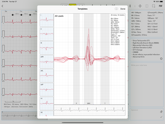 Screenshot #5 pour ECG for Doctors