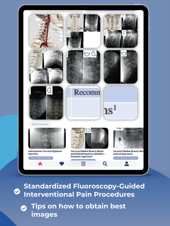 Screenshot #4 pour Interventional Pain App