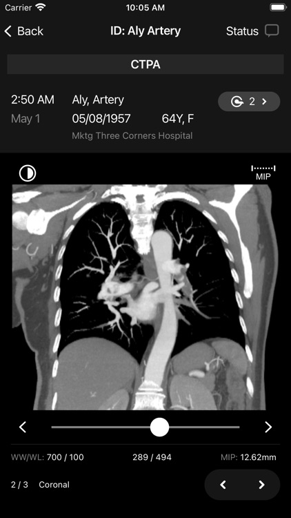 RapidAI screenshot-6