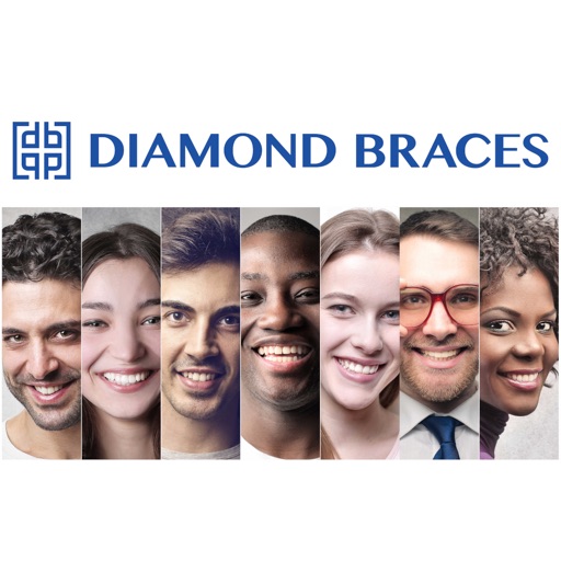 Diamond Braces