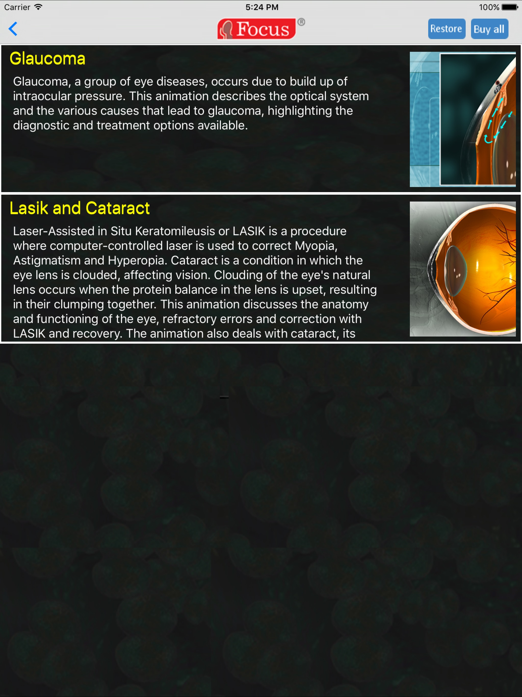 Ophthalmology - Understanding Disease