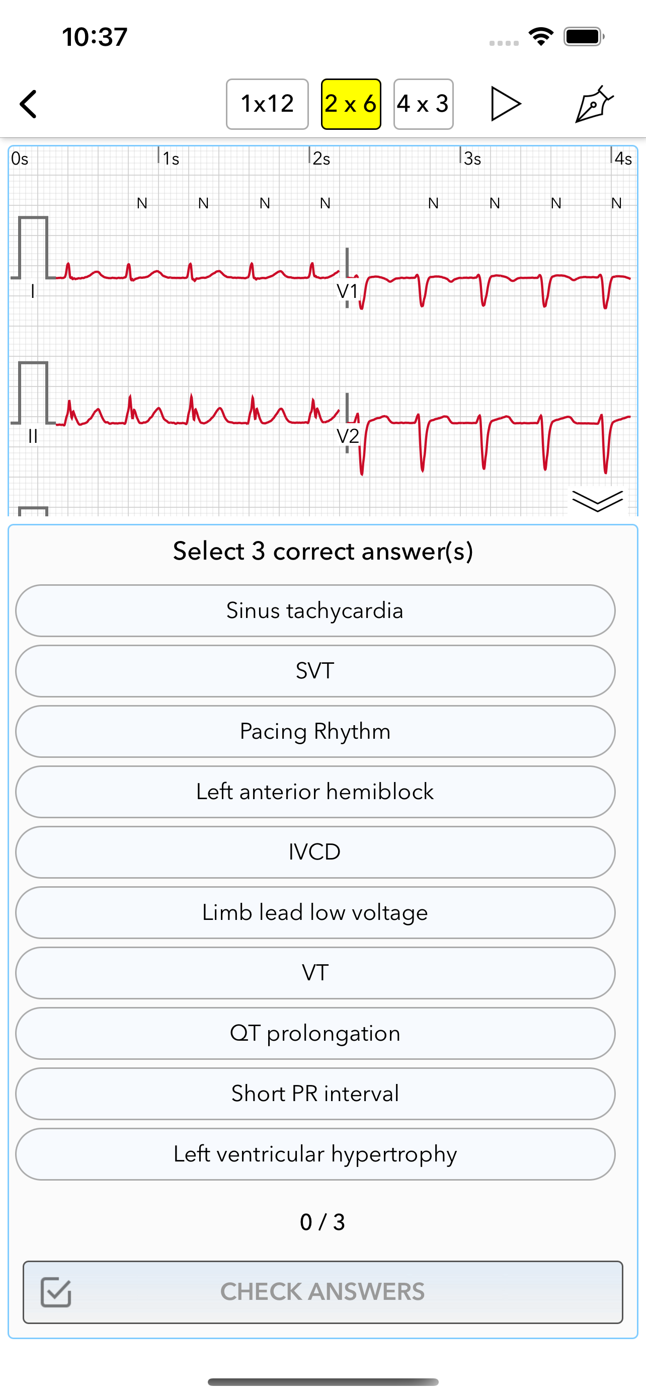 ECG Test for Doctors