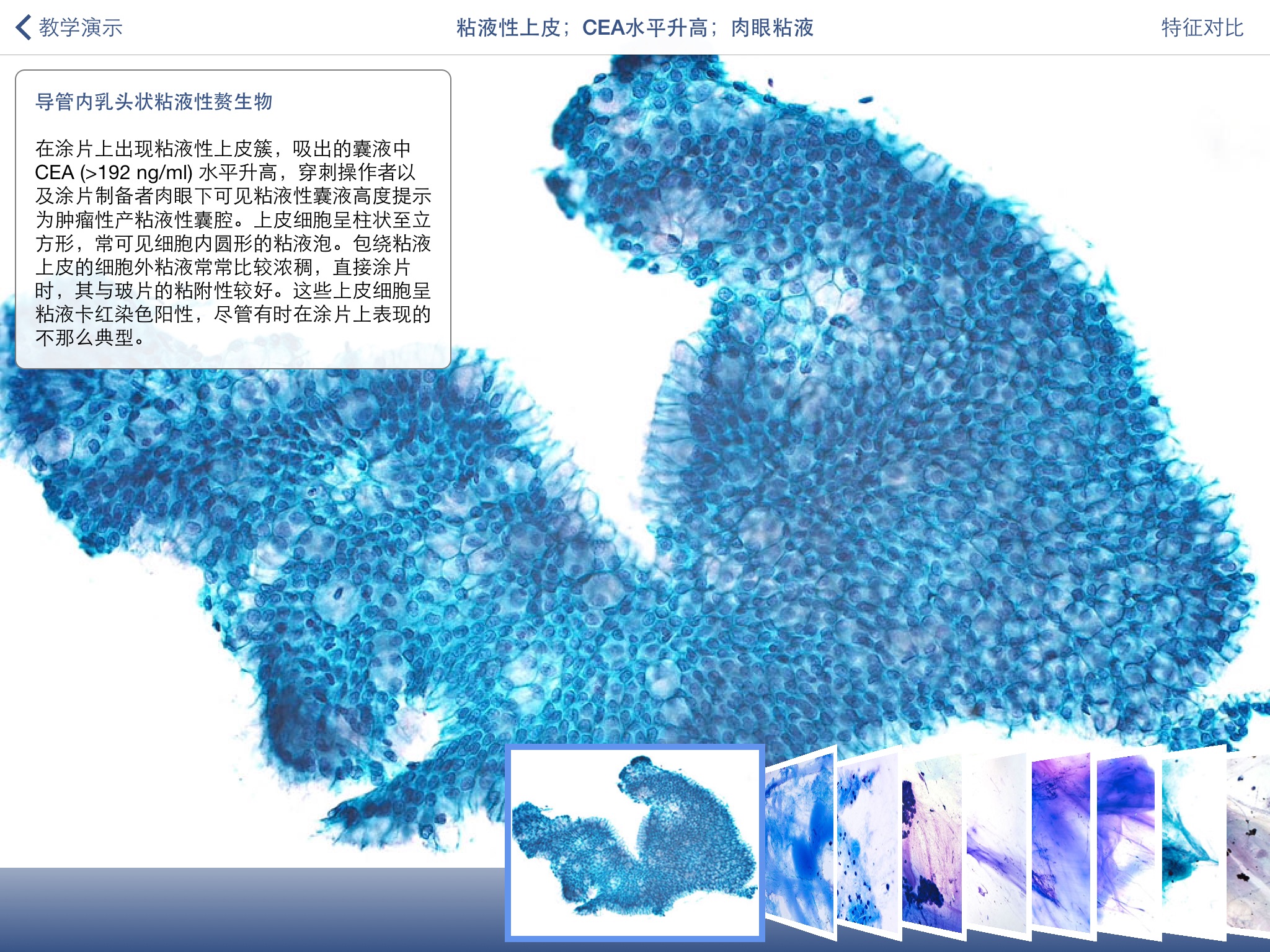 Johns Hopkins Atlas of Pancreatic Cytopathology screenshot 3