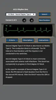 How to cancel & delete acls rhythm quiz 2