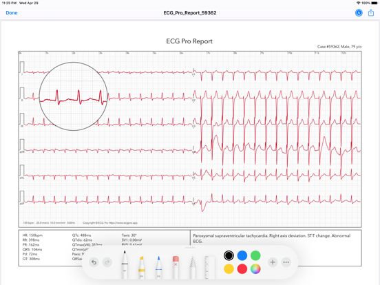ECG for Doctors iPad screenshot 8 - Medical app