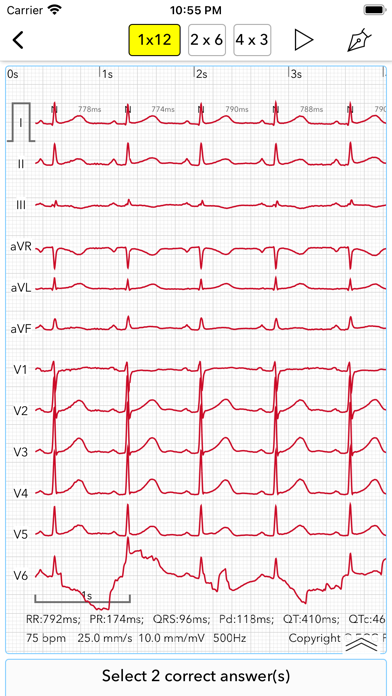 ECG Test Pro for Doctors Screenshot