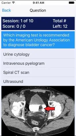 Game screenshot Nephrology Nursing (CNN) Review mod apk