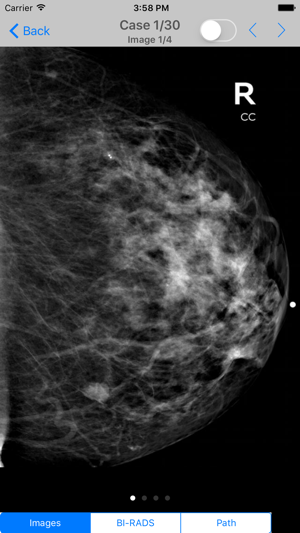 Mammogram Atlas(圖3)-速報App