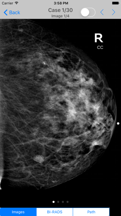 Mammogram Atlasのおすすめ画像3