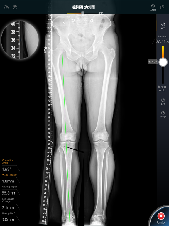 Screenshot #6 pour 截骨大师