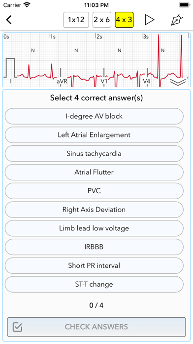 ECG Test Pro for Doctors Screenshot