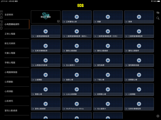 ECG Pro for Doctorsのおすすめ画像10