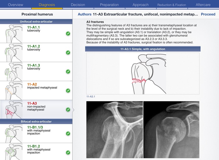 AO Surgery Reference HD