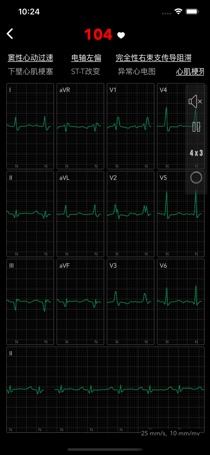 ECG for Doctors screenshot 7