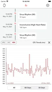 ecg+ | analyzer for qtc & hrv iphone screenshot 4