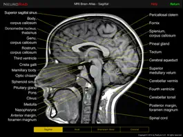Game screenshot NeuroRad mod apk