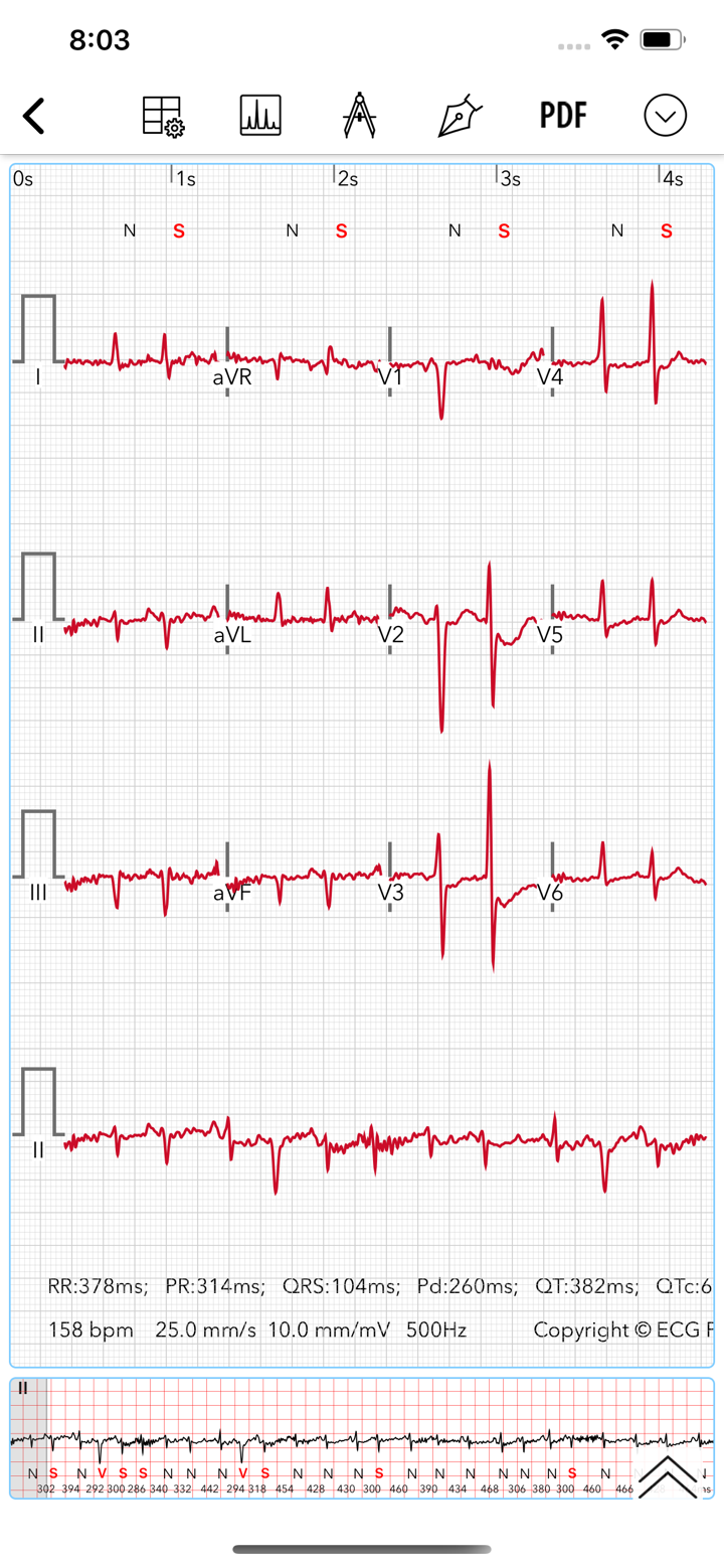 ECG for Doctors screenshot 2