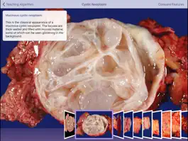 Game screenshot Johns Hopkins Atlas of Pancreatic Pathology hack