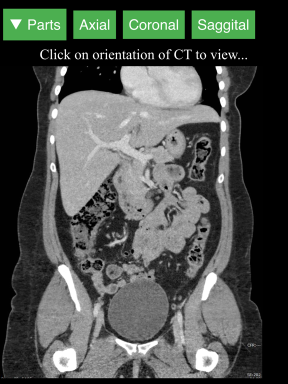 Radiology CT Viewerのおすすめ画像2