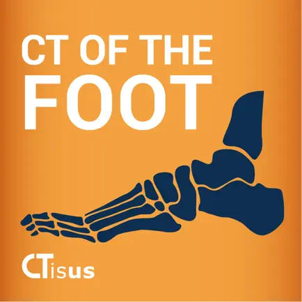 CTisus: CT of the Foot Cheats
